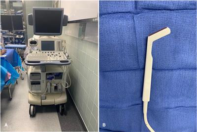 The Role of Intra-Operative Duplex Ultrasonography Following Translabyrinthine Approach for Vestibular Schwannoma